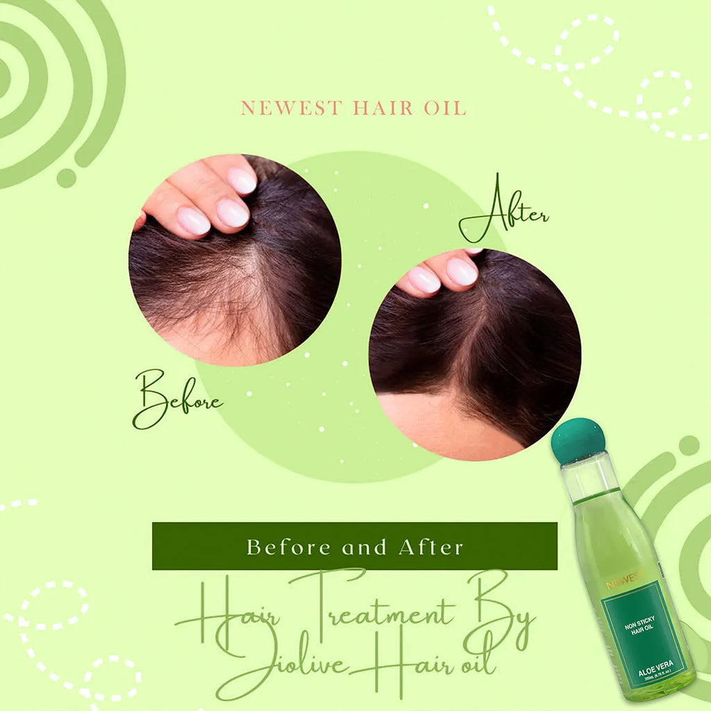 NEWEST NON STICK HAIR OIL ALOE VERA 200ML