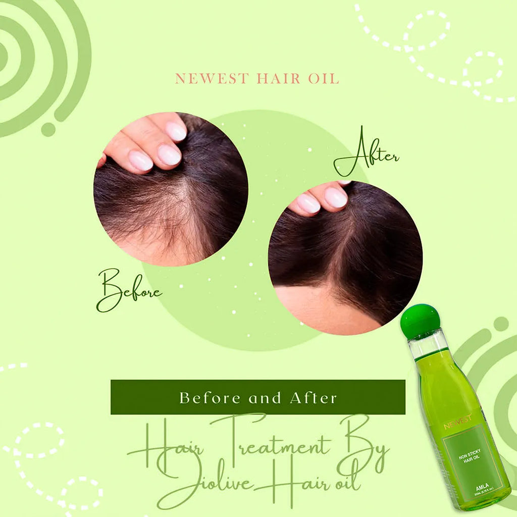NEWEST NON STICK HAIR OIL AMLA 200ML