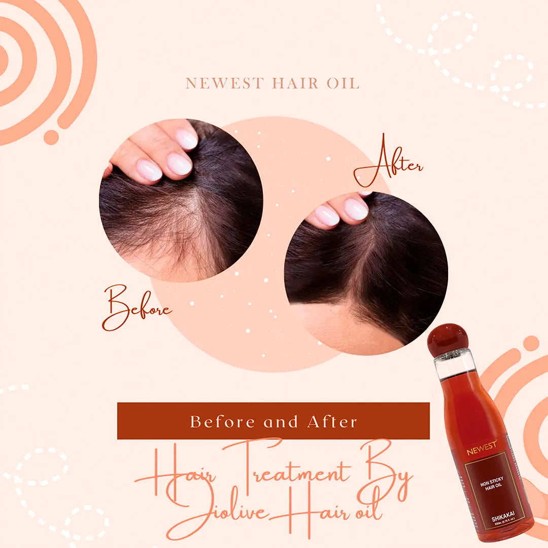 NEWEST NON STICK HAIR OIL SHIKAKAI 200ML